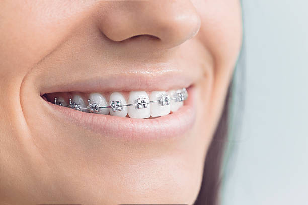 Best Veneers and Lumineers  in Beverly Hills, TX